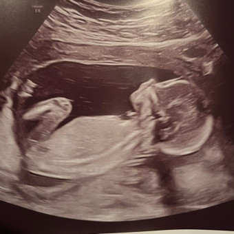 Babylist Registry Photo.
