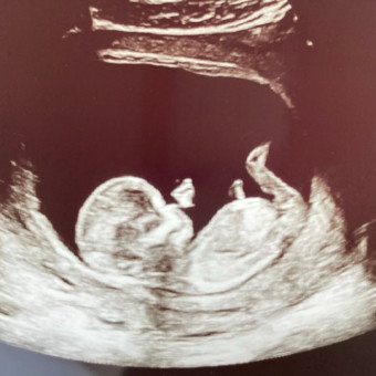 Babylist Registry Photo.