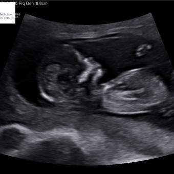 Babylist Registry Photo.