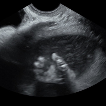 Babylist Registry Photo.