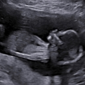 Babylist Registry Photo.