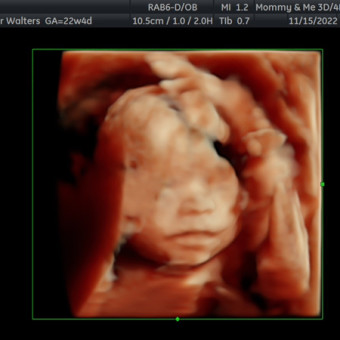 Babylist Registry Photo.