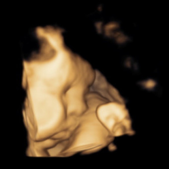 Babylist Registry Photo.
