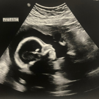 Babylist Registry Photo.