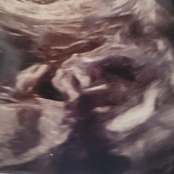 Babylist Registry Photo.