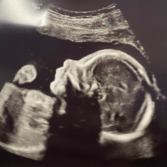 Babylist Registry Photo.