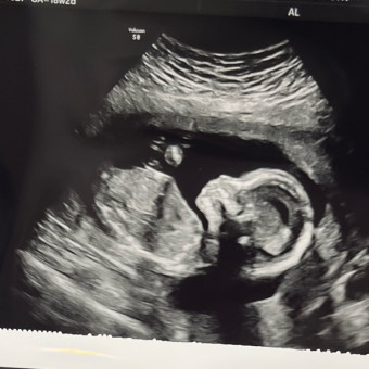 Babylist Registry Photo.