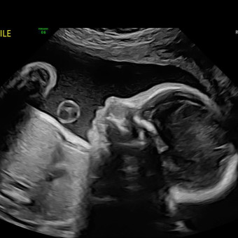 Babylist Registry Photo.