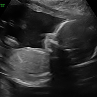 Babylist Registry Photo.