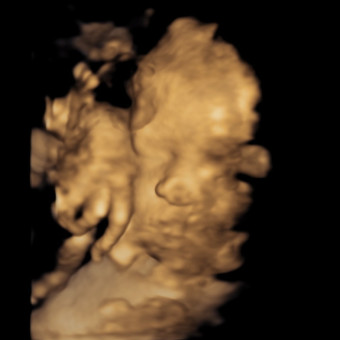 Babylist Registry Photo.