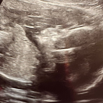 Babylist Registry Photo.