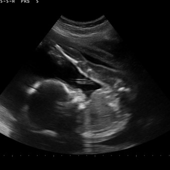 Babylist Registry Photo.