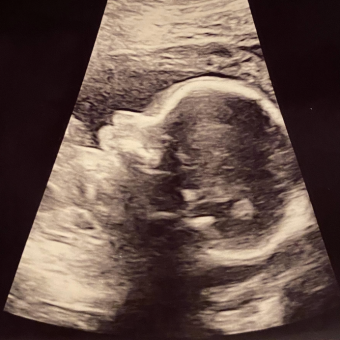 Babylist Registry Photo.