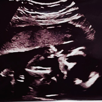 Babylist Registry Photo.