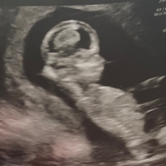 Babylist Registry Photo.
