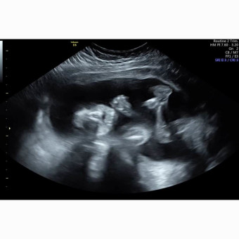 Babylist Registry Photo.