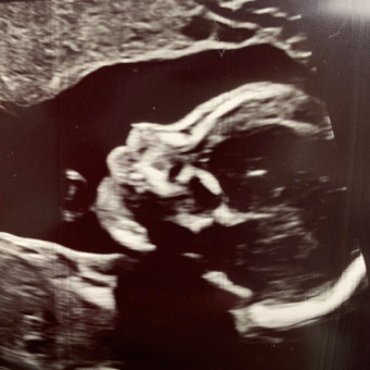 Babylist Registry Photo.