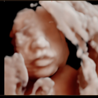 Babylist Registry Photo.