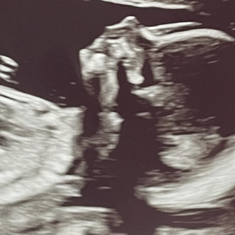Kennedy Watkins’ Baby Registry Photo.