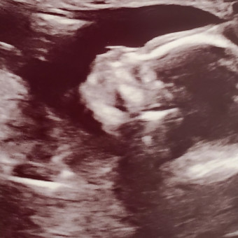 Babylist Registry Photo.
