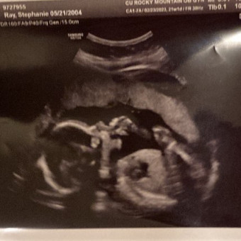 Babylist Registry Photo.