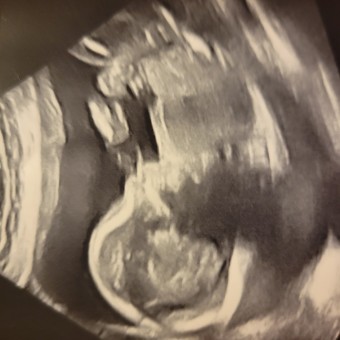 Babylist Registry Photo.