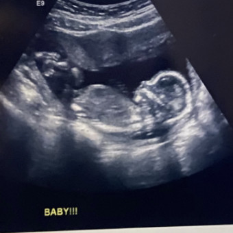 Mike & Bethany Konopelski’s Baby Registry Photo.