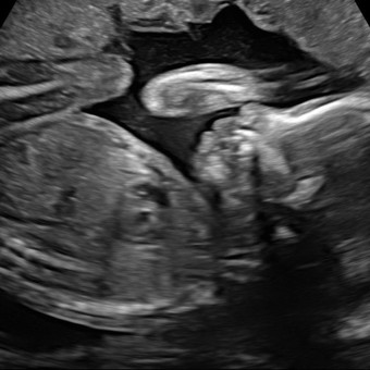 Babylist Registry Photo.