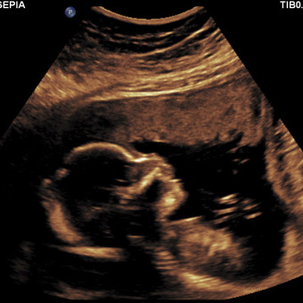 Babylist Registry Photo.