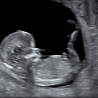 Babylist Registry Photo.