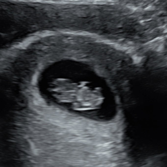 Babylist Registry Photo.