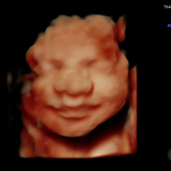 Babylist Registry Photo.
