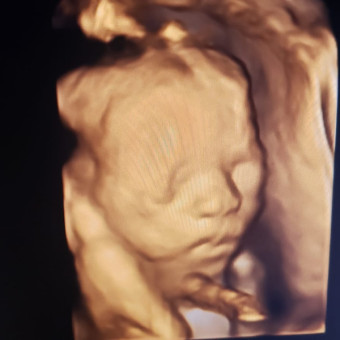 Babylist Registry Photo.