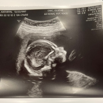 Babylist Registry Photo.