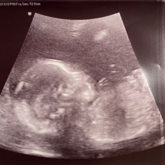 Babylist Registry Photo.