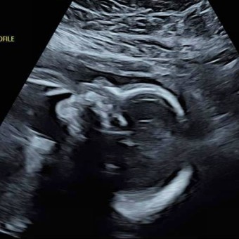 Babylist Registry Photo.