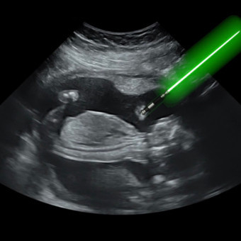 Babylist Registry Photo.