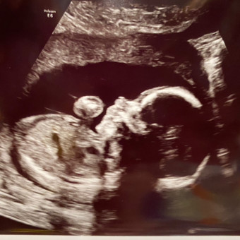Babylist Registry Photo.