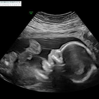 Babylist Registry Photo.