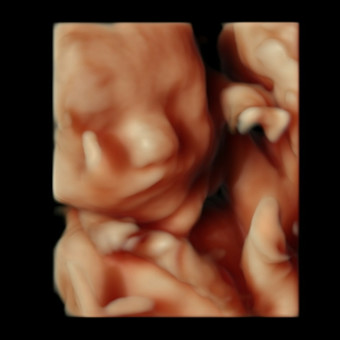Babylist Registry Photo.
