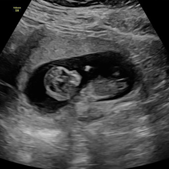 Babylist Registry Photo.