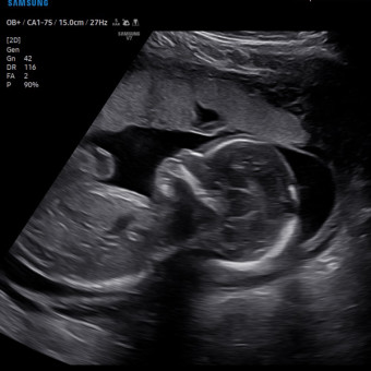 Babylist Registry Photo.