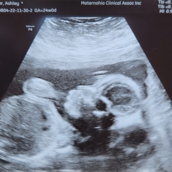 Babylist Registry Photo.