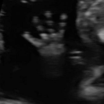 Babylist Registry Photo.