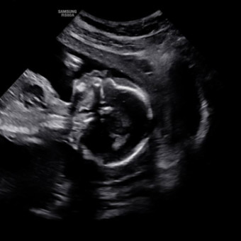 Babylist Registry Photo.
