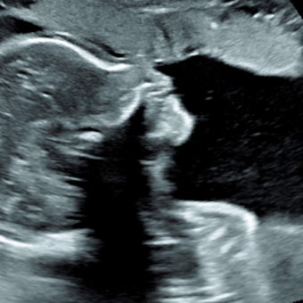 Babylist Registry Photo.