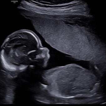 Babylist Registry Photo.