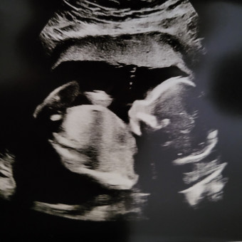 Morgan and Alex's Baby Registry Photo.