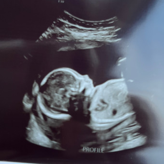 Babylist Registry Photo.