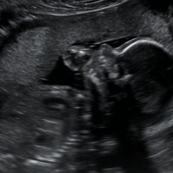 Babylist Registry Photo.